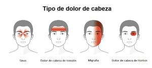 Dolor de cabeza o migrañas