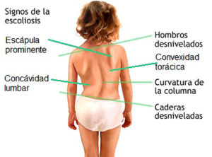 Tratamiento Quiropráctica Niños escoliosis